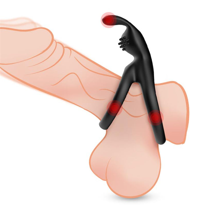 Penis ring